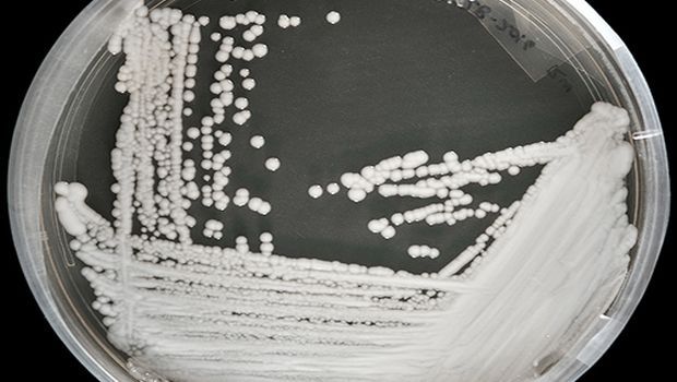 Pilzinfektionen breiten sich in den USA mit "alarmierender" Geschwindigkeit aus