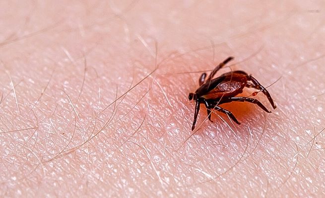 Seltene Zeckenkrankheit in England aufgetreten