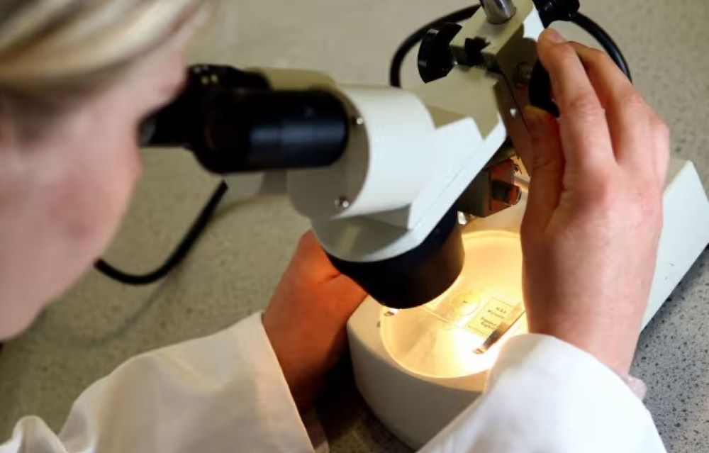 Eine frühe Studie zur Behandlung der Parkinson-Krankheit zeigt vielversprechende Anzeichen