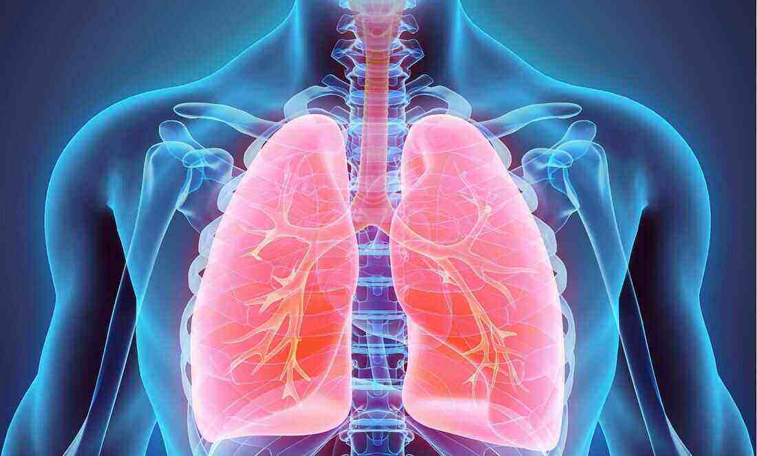 Laut einer Studie kann eine bessere Ernährung das Risiko von Tuberkulose-Todesfällen um 60 % senken